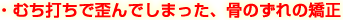 むちうちで歪んでしまった、骨のずれの矯正